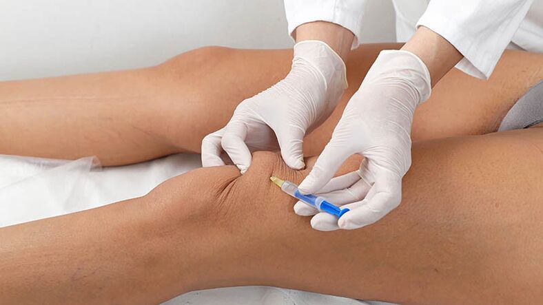 Intra -Artical injection for knee arthrosis