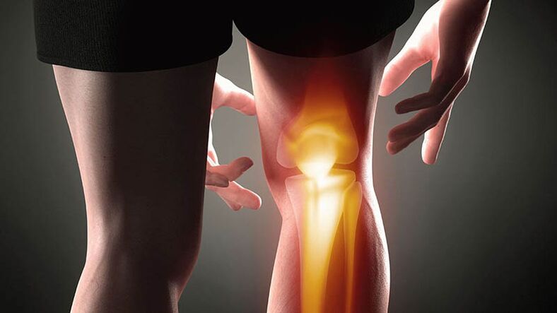 Knee wrist arthrosis
