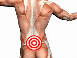 Osteochondrosis of lumbar spine